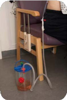Patient sitting in a chair with the chest drain tubing attached to a chest drain bottle on the floor.