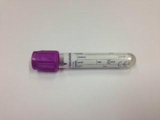 Container: EDTA blood sample