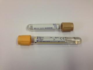 Container: Serum (Gold top) and Urine plain 5ml (Beige top)