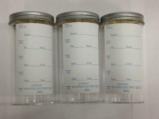 Container: TB Urine (3 containers)