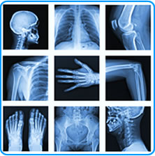 Collage of X-rays Collage of X-rays
