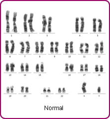 analyse chromosomes