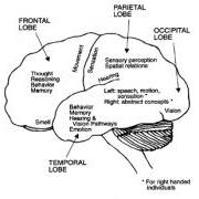 Glioma (Astrocytoma)