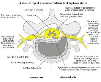 Diagram of cervical vertebrae