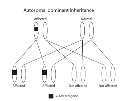 Autosomal dominant inheritance - gene diagram showing how an altered gene can be passed on