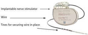 Interstim SureScan device