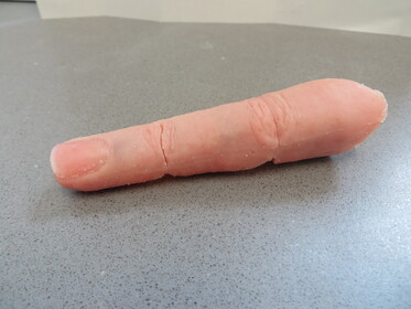 Movable finger prosthesis Movable finger prosthesis