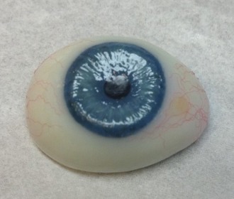 Ocular prosthesis Ocular prosthesis