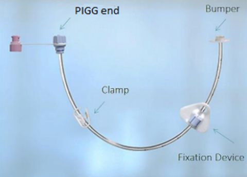 Photo of PIGG tube.