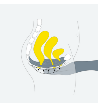 Diagram showing the location of the pelvic floor muscle