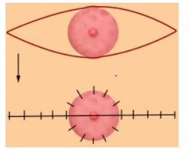 A diagram showing where the surgeon will make a semi-circular cut around the areola and where the stitches will be placed.