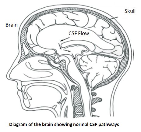 Diagram of brain and normal CSF pathways