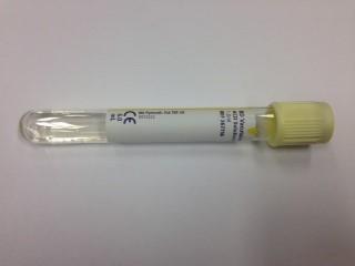 Container: Citrate (Yellow top)