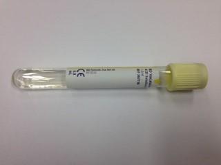 Container: Citrate (Yellow top) or EDTA (lavender top)