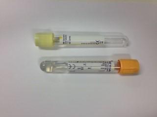 Container: Citrate (Yellow top) and Serum (Gold top)