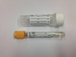 Container: Serum (Gold top) and Universal (white top)