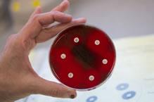 Photo of hand holding petri dish with visible cultures