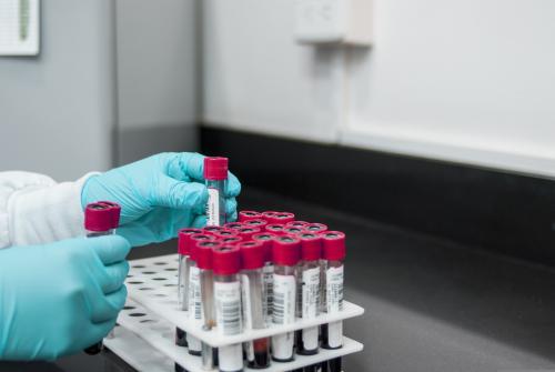 Vials of blood in a test tube holder