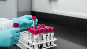Vials of blood in a test tube holder